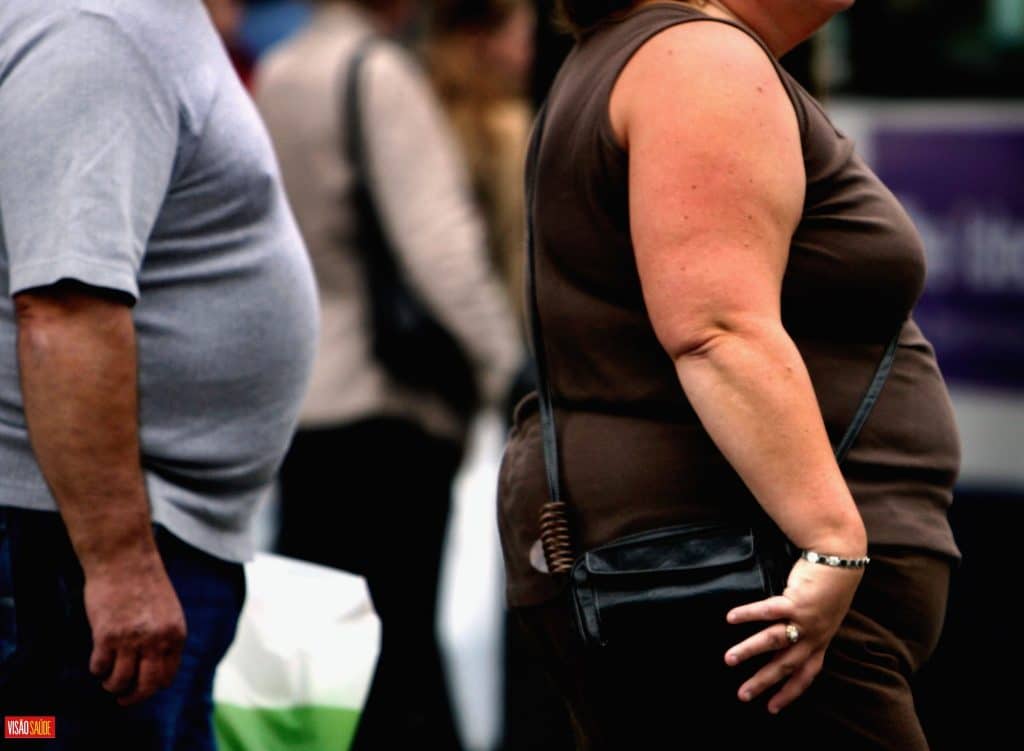 New international guidelines increase the eligibility of obese people for bariatric surgery