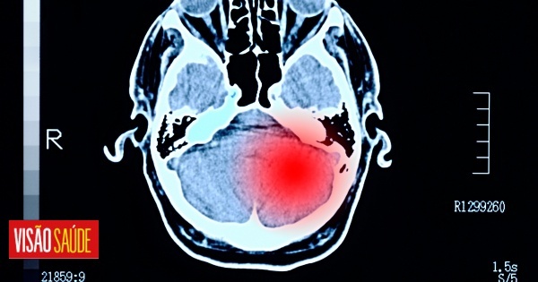 New brain tumor vaccine appears to increase lifespan of brain tumor sufferers, study shows